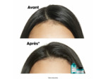 Shampooing dermo-purifiant anti-gras Scalp Advanced 1500ml