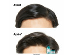 Shampooing dermo-purifiant anti-gras Scalp Advanced 1500ml