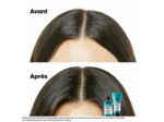 Shampooing dermo-régulateur anti-inconfort Scalp Advanced 1500ml