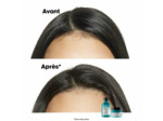 Shampooing dermo-purifiant anti-gras Scalp Advanced 300ml
