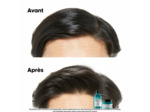 Shampooing dermo-purifiant anti-gras Scalp Advanced 300ml