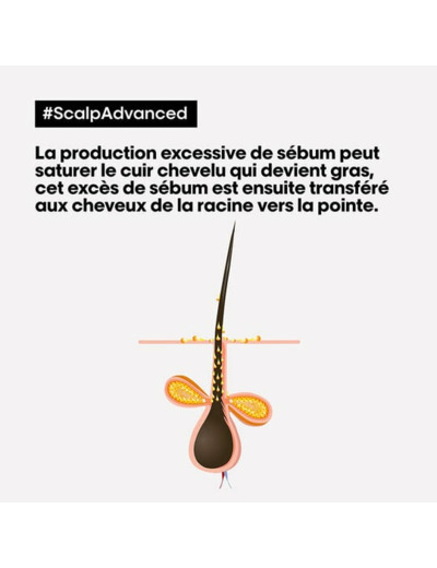 Routine anti-gras Scalp Advanced