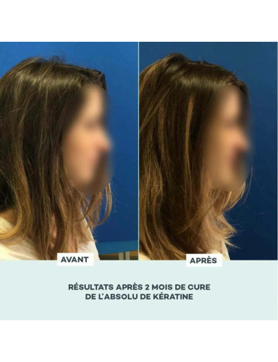Absolu De Kératine 3 Mois Comprimés