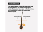Shampooing dermo-clarifiant anti-pelliculaire Scalp Advanced 500ml