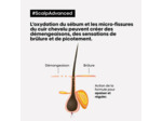 Shampooing dermo-régulateur anti-inconfort Scalp Advanced 1500ml