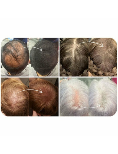 Fibres densifiantes pour cheveux châtain foncé
