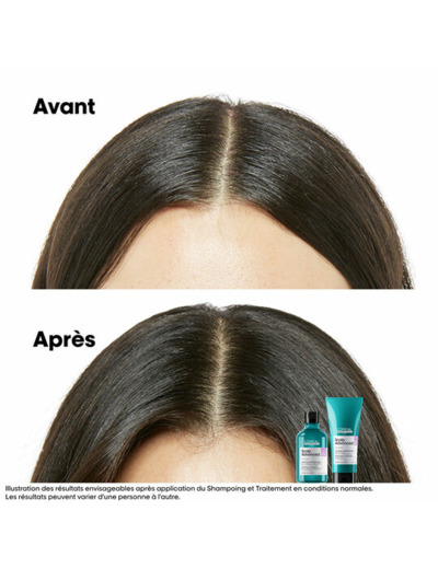 Shampooing dermo-régulateur anti-inconfort Scalp Advanced 1500ml