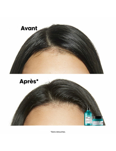 Shampooing dermo-purifiant anti-gras Scalp Advanced 1500ml