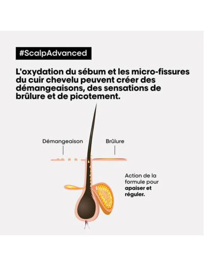 Shampooing dermo-régulateur anti-inconfort Scalp Advanced 500ml