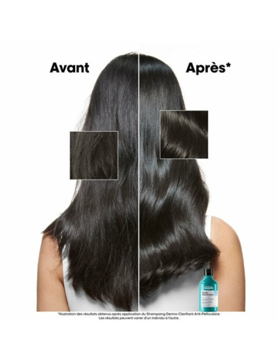 Shampooing dermo-clarifiant anti-pelliculaire Scalp Advanced 500ml