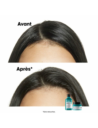 Shampooing dermo-purifiant anti-gras Scalp Advanced 300ml