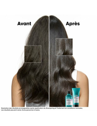 Shampooing dermo-régulateur anti-inconfort Scalp Advanced 300ml