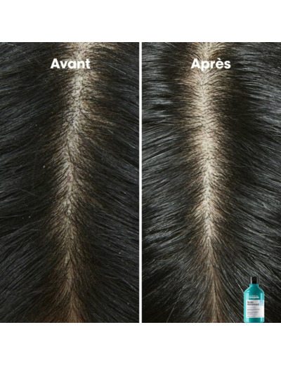 Shampooing dermo-clarifiant anti-pelliculaire Scalp Advanced 500ml